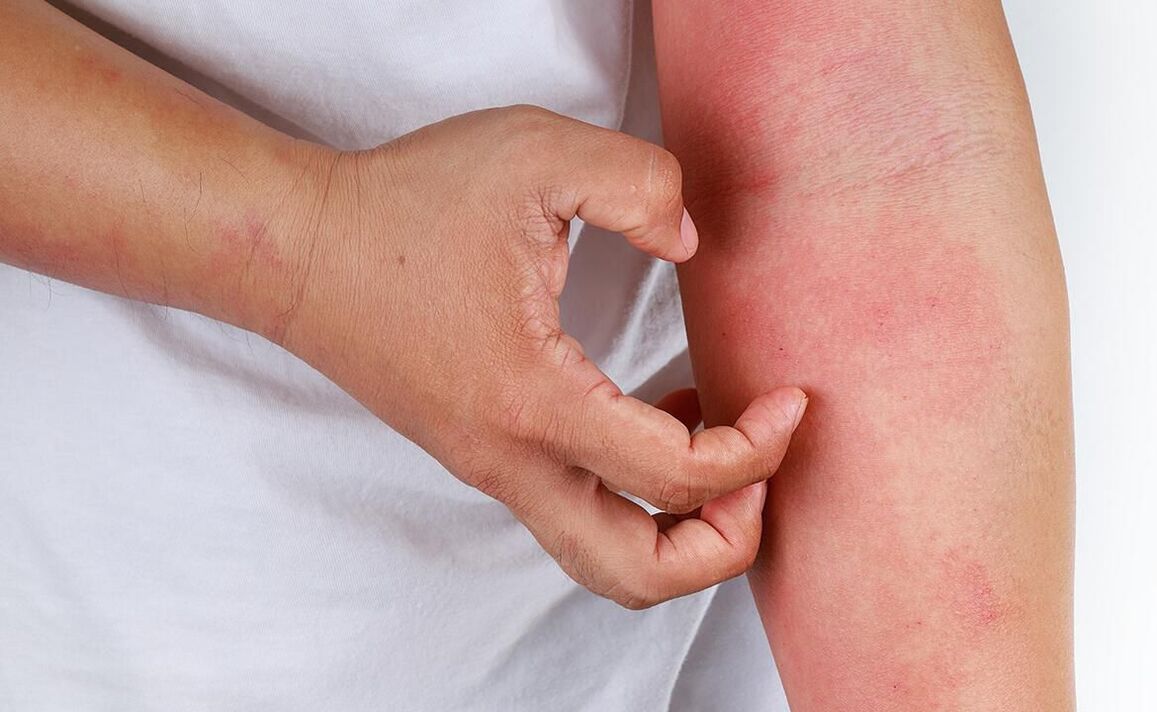 Սոդայի օգտագործման հնարավոր բարդությունները